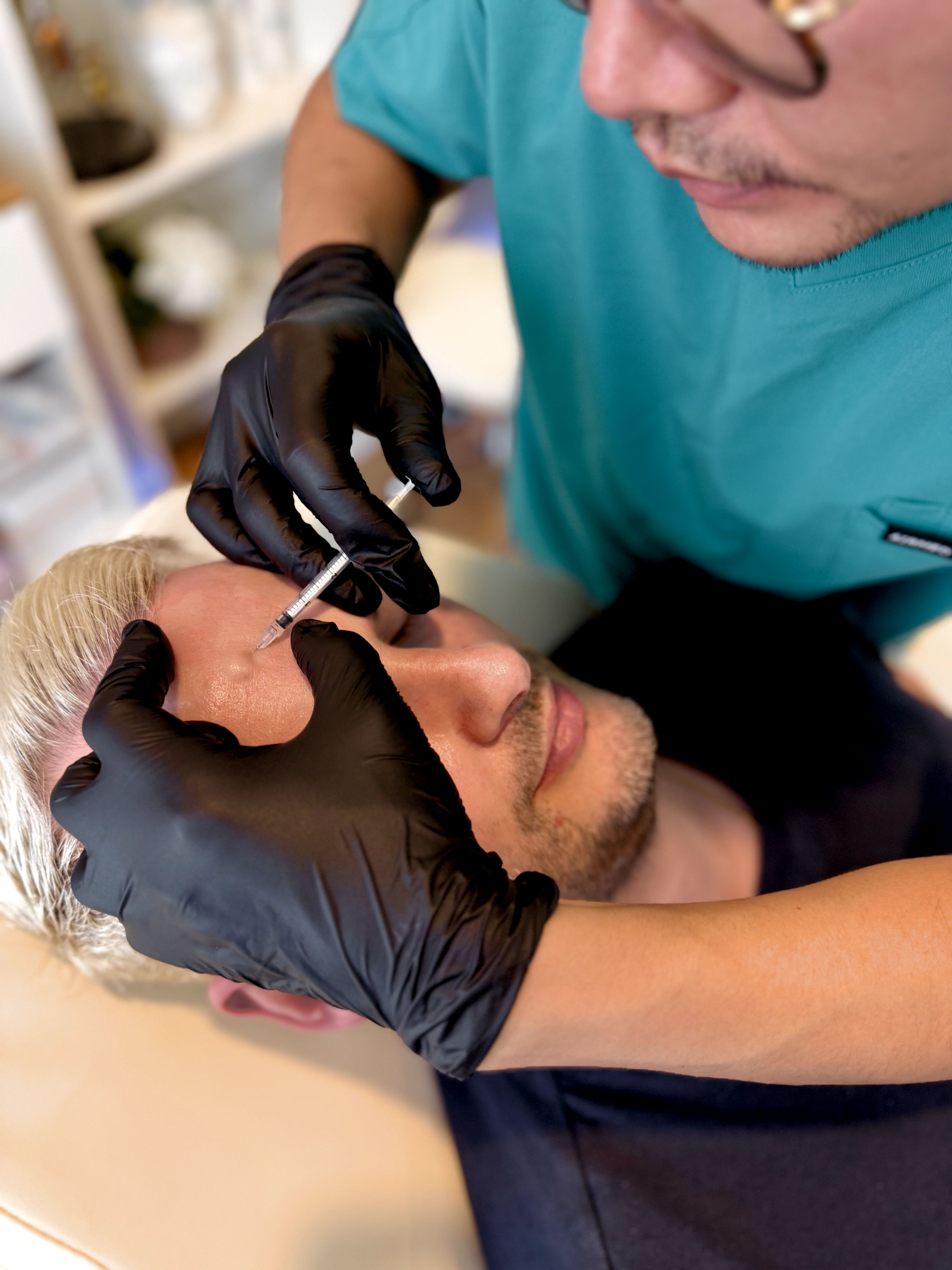 A detailed view of the microneedling process on facial skin