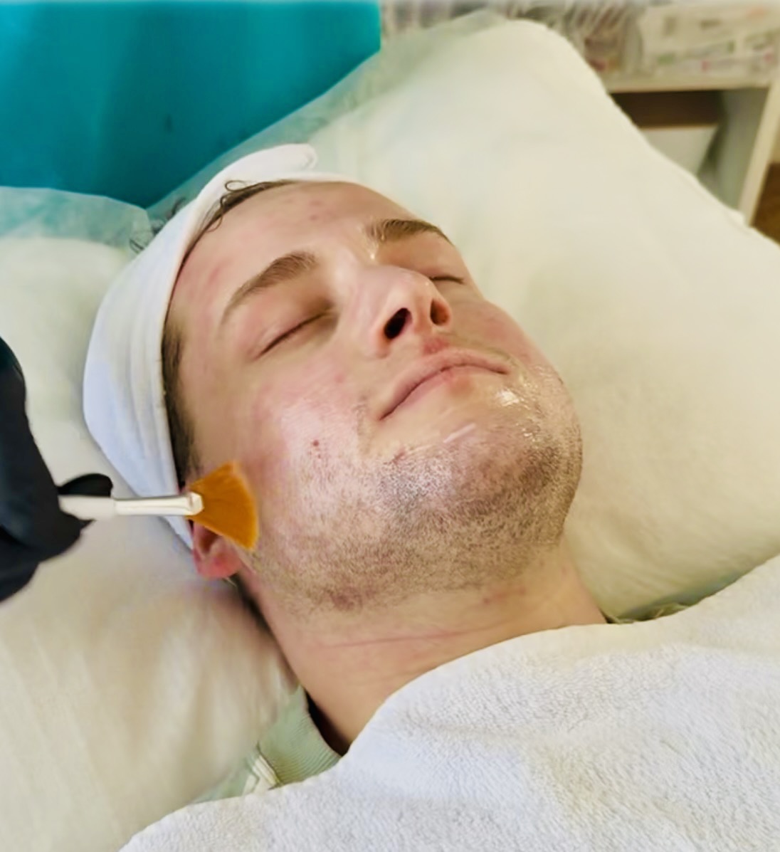 Close-up view of a therapist applying a dermatological peel to a client's face