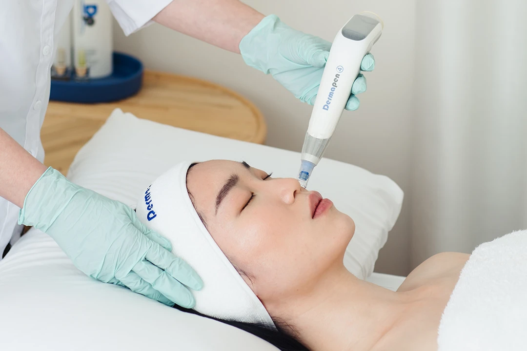 Diagram showing how Dermapen microneedling works